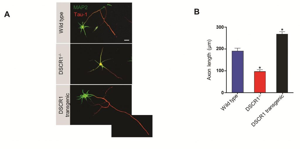 생쥐 뇌에 있는 '해마'의 뇌 신경세포의 축삭돌기 발달이 DSCR1의 발현 양에 따라 크게 차이가 난다. 왼쪽은 공초점 현미경 이미지이고, 오른쪽은 신경세포 길이를 측정한 그래프다. 