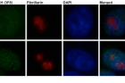 그림-1-정상-영양분-부족-상태의-세포내-SHPRH-단백질-분포-비교.png