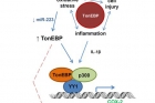 그림3_간암-발생-과정에서-톤이비피-유전자의-역할.jpg