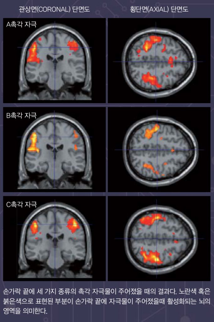 fMRI 사진.