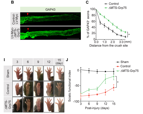 [그림 1] Grp75 유전자의 과발현으로 좌골신경이 손상된 실험 쥐의 신경이 재생되는 모습