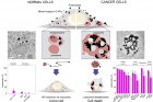 연구그림-정상세포와-암세포에서-세포-내-섭취작용을-통해-흡수된-금속-나노입자의-거동비교.jpg