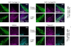 연구그림-도파민-신경세포에서-오글루넥당화O-GlcNAcylation를-증가시켰을-때의-변화.jpg