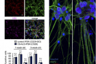 연구그림-루게릭-환자-유도만능줄기세포에서-유래된-세포가-신경세포임을-검증함.jpg