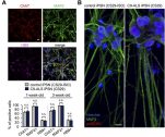 [연구그림] 루게릭 환자 유도만능줄기세포에서 유래된 세포가 신경세포임을 검증함