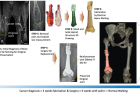 연구그림-3D-프린팅-Ti-6Al-4V-임플란트인공-뼈를-이용한-골종양-치료-진행과정.jpg