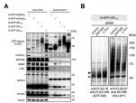 [연구그림] 단백질 번역 품질관리 인자의 독성 단백질 제거 기능 검증