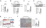 [연구그림] TET 억제 실험쥐의 지방세포에서 베타3 아드레날린 수용체의 발현과 열 생성 증가
