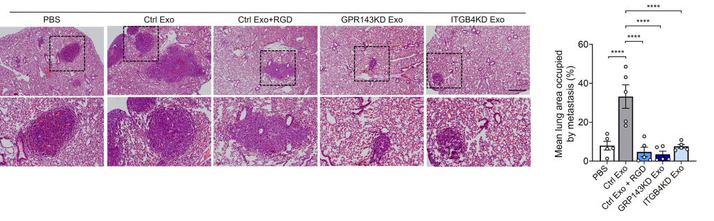 그림2. GPR143이 발현된 암세포에서 분비되는 엑소좀을 처리하였을 경우 혈액내순환종양세포가 폐조직으로 더 많은 전이가 이루어짐