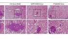 연구그림2-GPR143이-발현된-암세포에서-분비되는-엑소좀을-처리하였을-경우-혈액내순환종양세포가-폐조직으로-더-많은-전이가-이루어짐.png