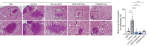 [연구그림2] GPR143이 발현된 암세포에서 분비되는 엑소좀을 처리하였을 경우 혈액내순환종양세포가 폐조직으로 더 많은 전이가 이루어짐