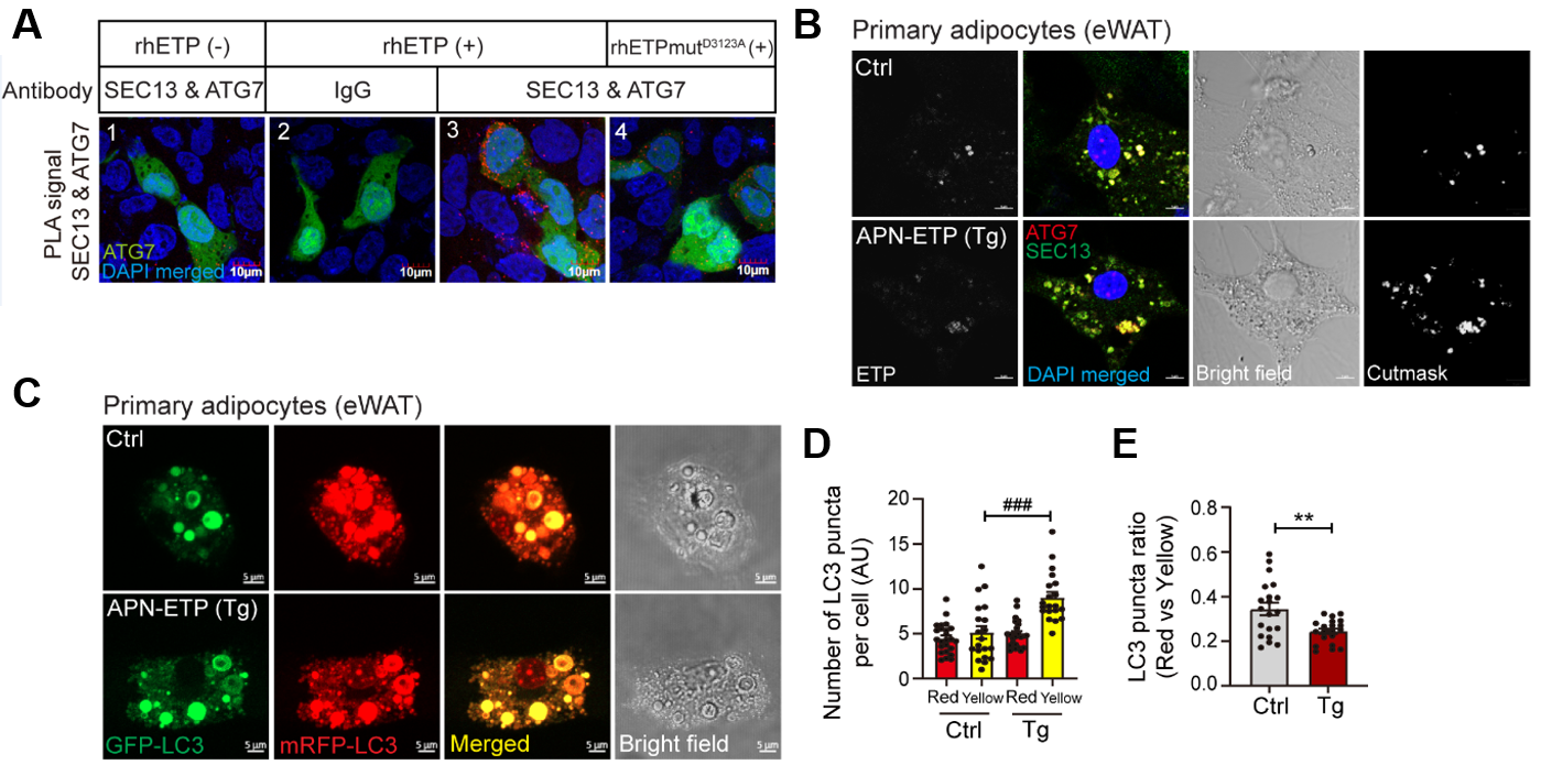 그림2. 세포 내 엔도트로핀은 SEC13과 ATG7의 상호작용을 직접적으로 매개하여 비만한 상황에서 지방세포 내 autophagosome 형성을 촉진하고 autophagic flux를 저해함