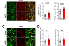 연구그림2-도파민-신경세포의-축삭-말단에서-PLCγ1이-결손되었을-때-도파민-분비를-조절하는-VMAT2-synapsin-III의-양이-증가.png