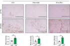 연구그림1-유방암-마우스-모델의-암-연관-지방조직-sWAT의-FAM3C의-억제로-인해-지방세포의-세포-사멸-CC3과-섬유화-Fibronectin-Sirius-Red가-증가함.png