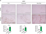 [연구그림1] 유방암 마우스 모델의 암 연관 지방조직 (sWAT)의 FAM3C의 억제로 인해 지방세포의 세포 사멸 (CC3)과 섬유화 (Fibronectin, Sirius Red)가 증가함