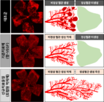 [연구그림2] 개발물질의 망막병증 치료 활성 비교