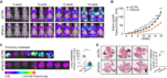 [연구그림2] 유방암 마우스 모델의 암 연관 지방세포 (sWAT)의 FAM3C 억제로 인한 유방암 성장 및 전이 억제
