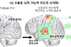 연구그림1-iEEG-Microdisplay를-이용한-뇌의-기능적-지도-시각화가-가능해질-경우의-기대효과.png