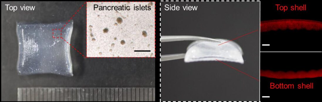 연구팀은 다층 시트형 구조를 고안해 피하 조직에서도 효율이 높은 이식체 개발에 성공했다. 혈관과 췌도 간의 거리를 최소화할 수 있게 이식체의 상부층과 하부층에 췌도가 집중된 구조다. 또 췌도의 분포 밀도를 정교하게 조절해 충분한 산소와 영양분을 전달받을 수 있다. 췌도 외에 이식체를 구성하는 물질은 모두 생체 친화 물질이다.