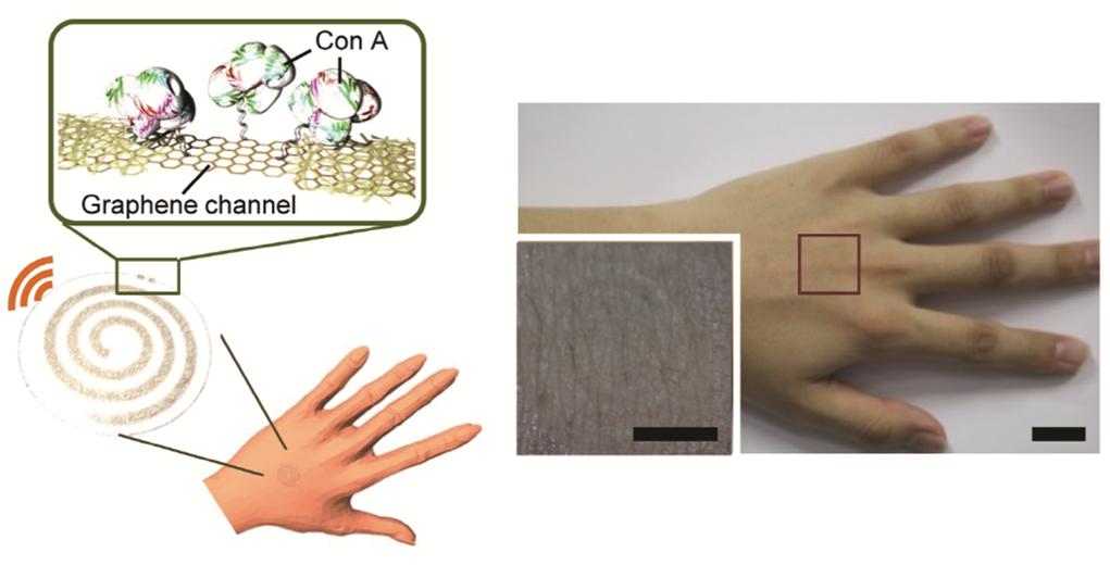 Wearable wireless smart sensor, composed of the antenna and electrodes based on hybrid structure, and a graphene channel. These graphene-metal nanowire hybrid nanostructures are trasparent when attached to the skin of the back of a human hand and show high electrical conductivity even under high stretching and bending strain.