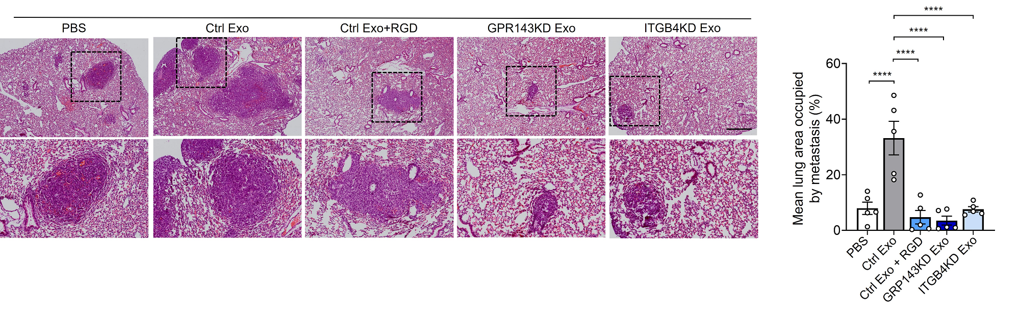 연구그림2-GPR143이-발현된-암세포에서-분비되는-엑소좀을-처리하였을-경우-혈액내순환종양세포가-폐조직으로-더-많은-전이가-이루어짐