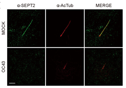 HCoV-OC43 infection reduces SEPT2 and increases deciliation in ciliary cells