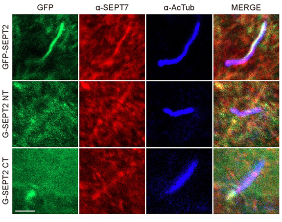 The cleaved SEPT2 fragments affect ciliogenesis by preventing the translocation of ciliary SEPTs