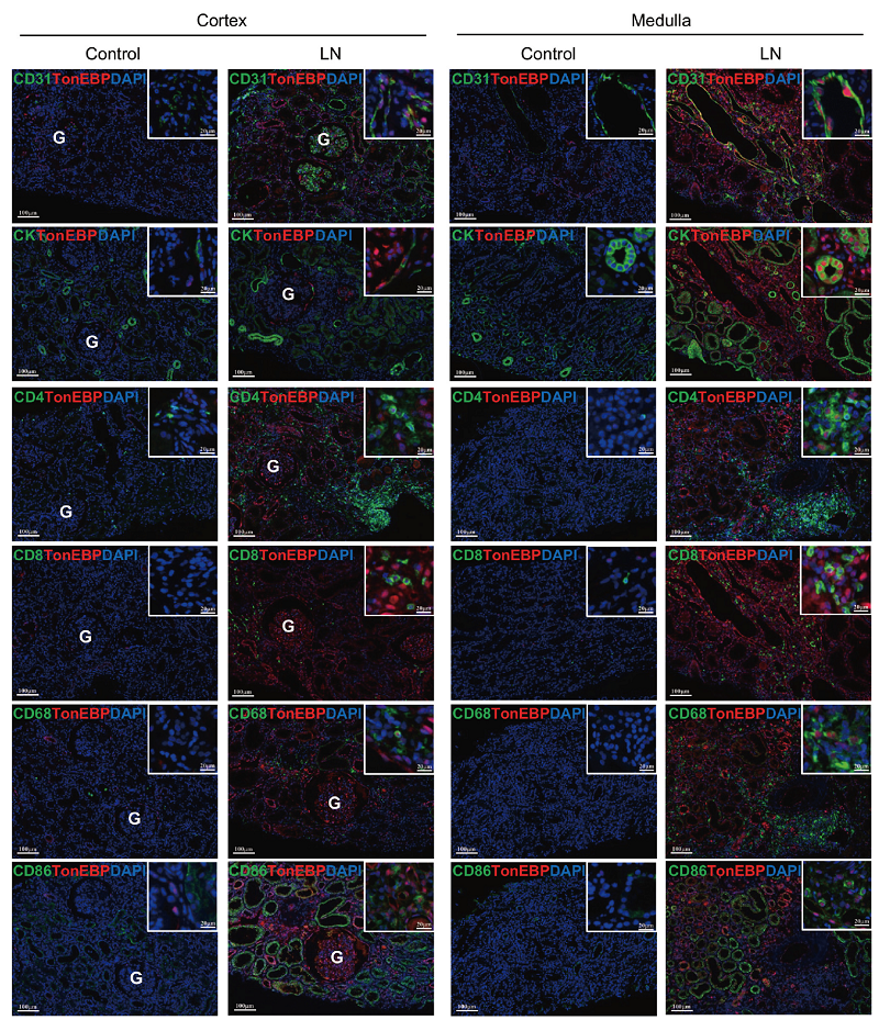 TonEBP expression in endothelial cells, epithelial cells, and infiltrating immune cells in renal biopsy tissues subjected to multiplex immune fluorescence staining.