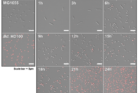 연구그림2-Scheme-D-배양-방식을-적용하여-발효-반응기-내에서-먹이-박테리아인-대장균E.-coli-K-12-MG1655와-포식박테리아B.-bacteriovorus-HD100의-성장을-시간에-따라-현미경으로-보여주는-그림.png