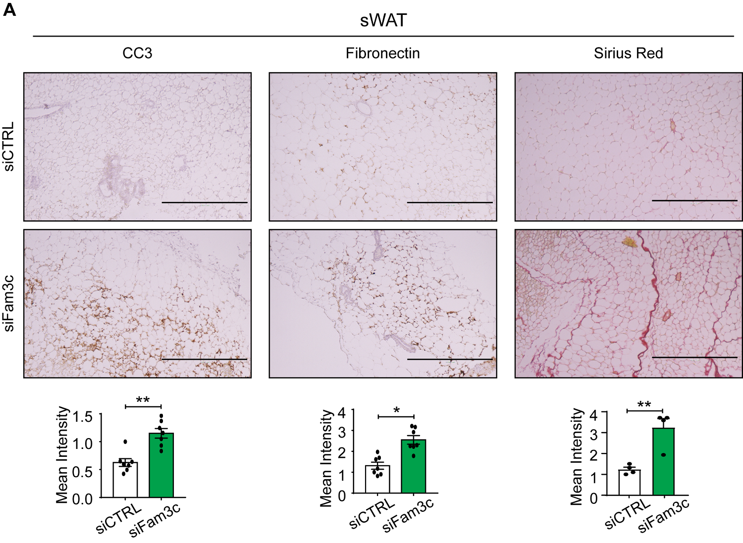 Figure 1. Fam3c knockdown in sWAT of MMTV-PyMT mice increases cell death and fibrosis of CAAs, ultimately inhibiting the growth and metastasis of primary tumors.