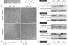 Caspase-4-5-mediated-pyroptosis-by-oxidative-photocatalysis-on-membranes..png