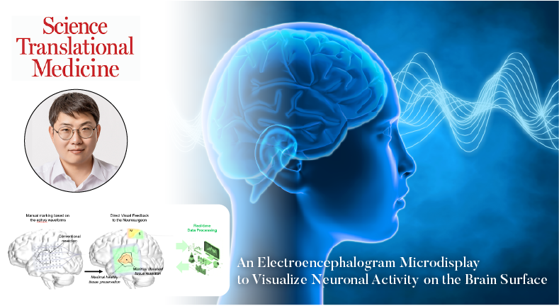 Revolutionary iEEG-Microdisplay Unveiled to Enhance Brain Surgery Success
