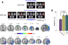 Fig-1.-Experimental-paradigm-and-lesion-reconstruction..png