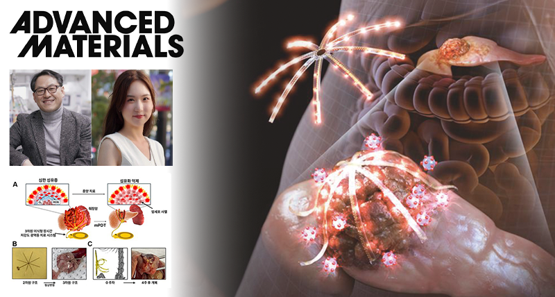 New Study Unveils Deeply Implantable, Shape-Morphing, 3D MicroLEDs for Pancreatic Cancer Therapy